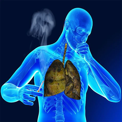 Respiratory Health